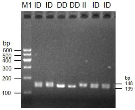 DNA detection method for detecting weight trait of black-head sheep in western Shandong and application of DNA detection method