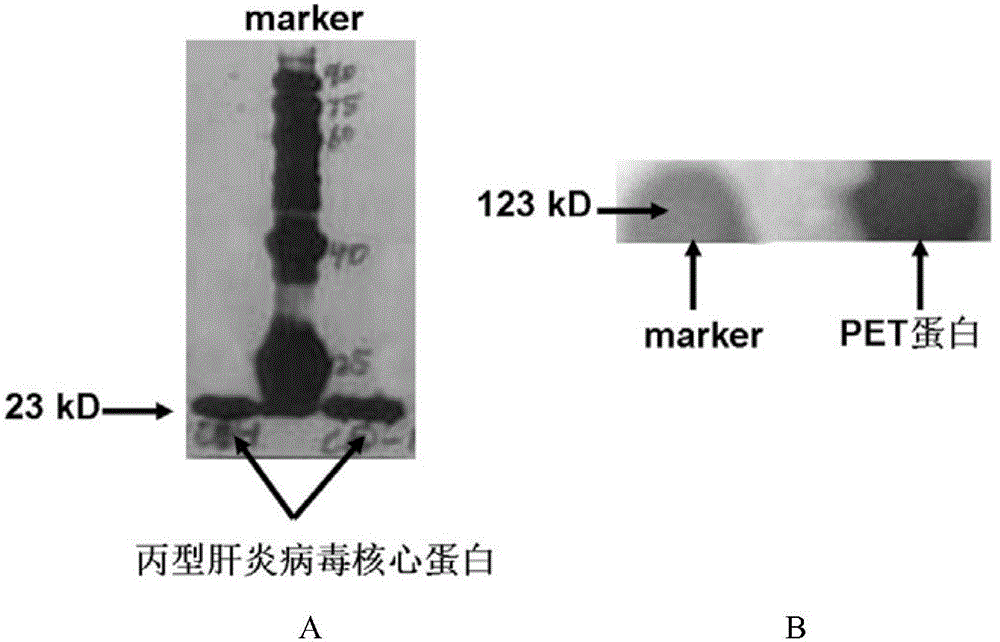 Aptamer with affinity to viral hepatitis C core antigen and application thereof