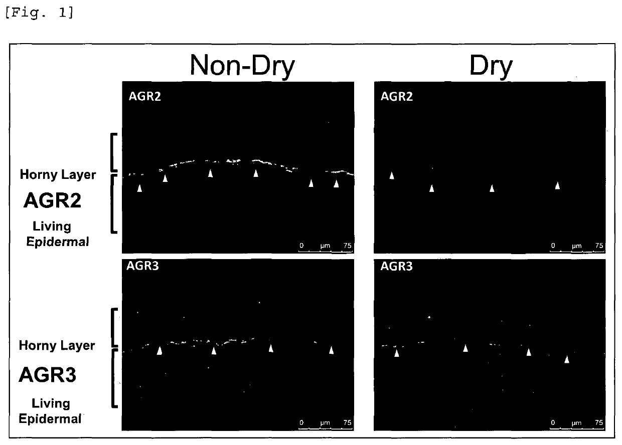 Method for evaluating condition of skin dryness