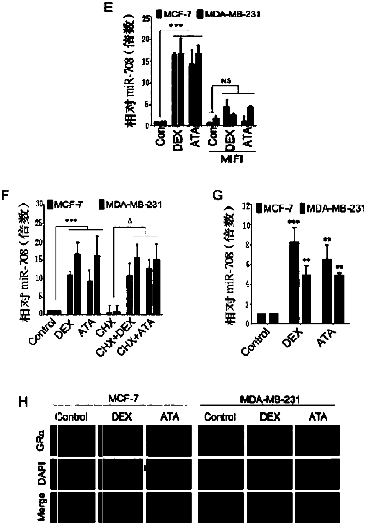 Application of glucocorticoid receptor accelerator antcin A in inhibiting tumorigenesis and metastasis of breast cancer