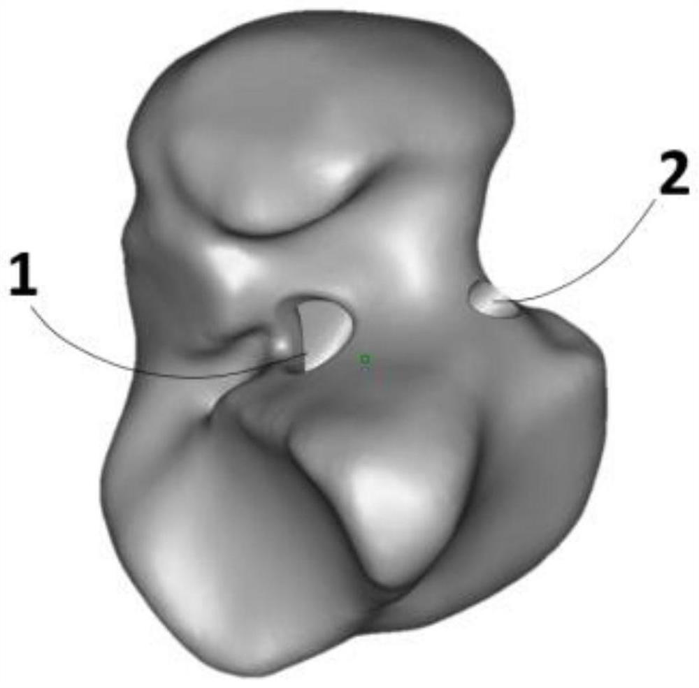 Non-fixed hollow talus prosthesis and forming method