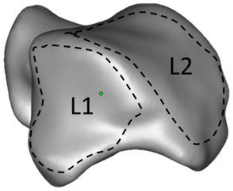 Non-fixed hollow talus prosthesis and forming method