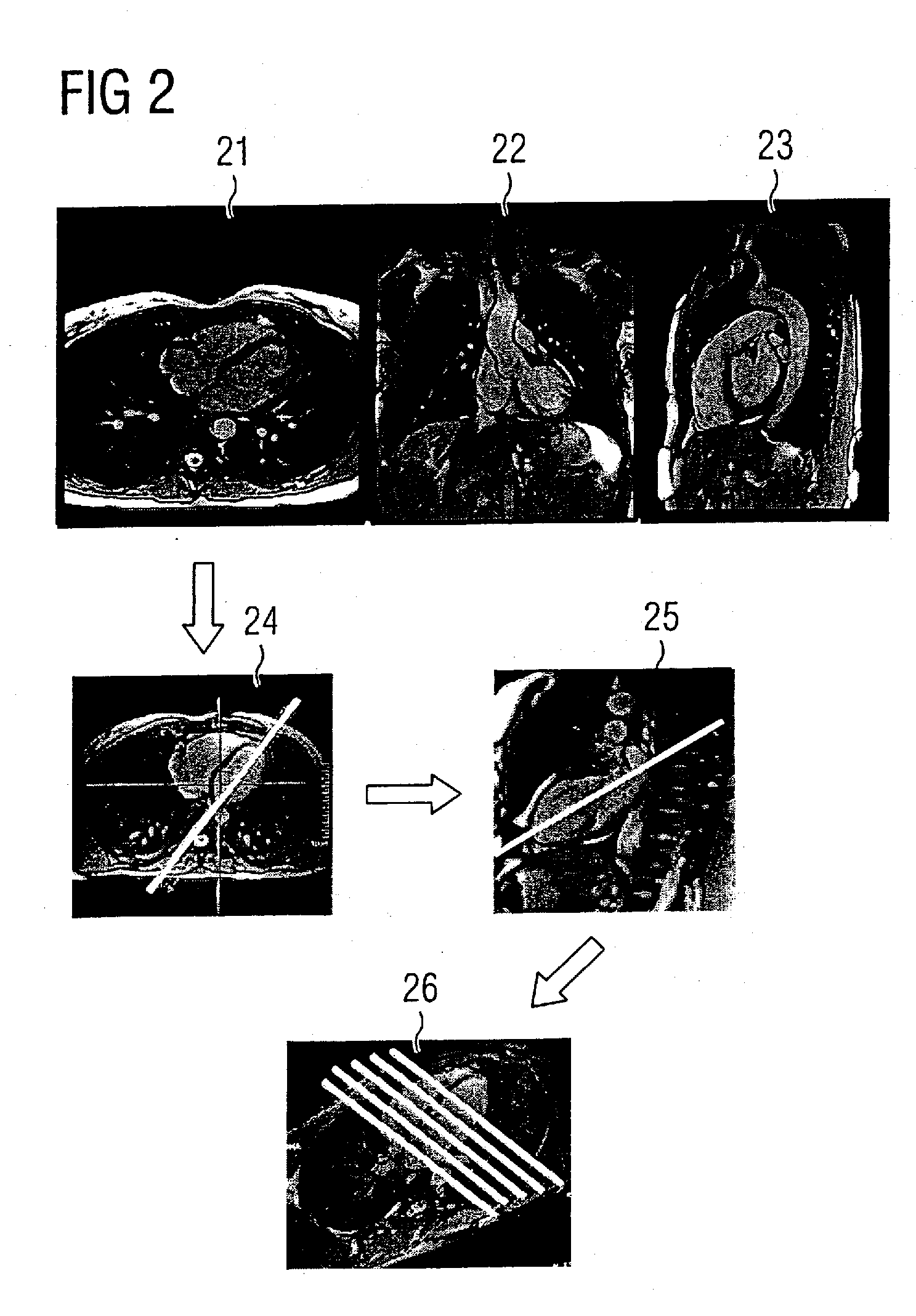 Magnetic resonance system and method for cardiac imaging