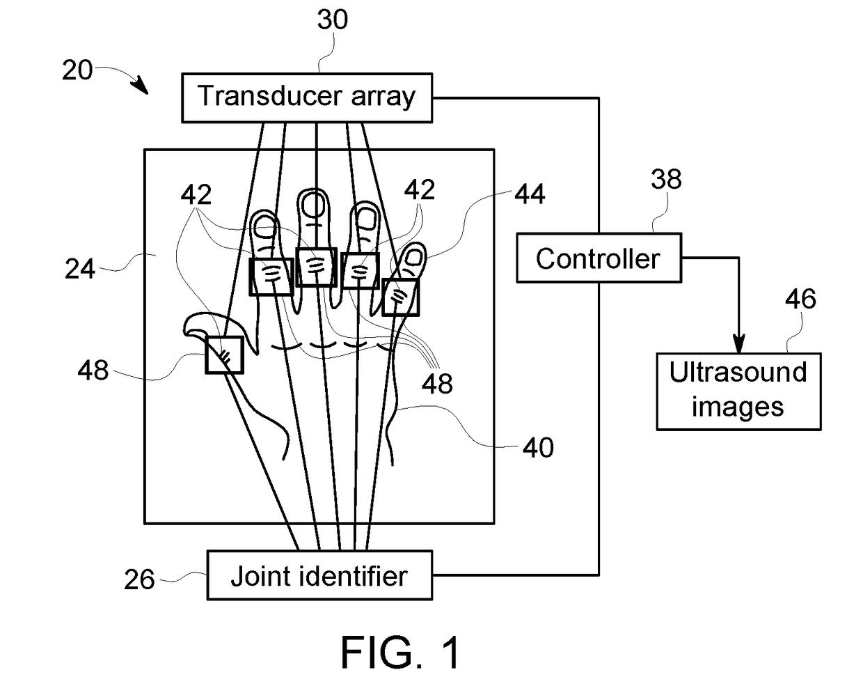 Auto finger joint detection for robotic hand ultrasound scanner