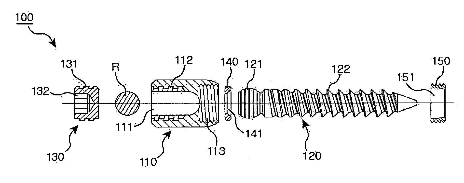 Spinal pedicle screw assembly