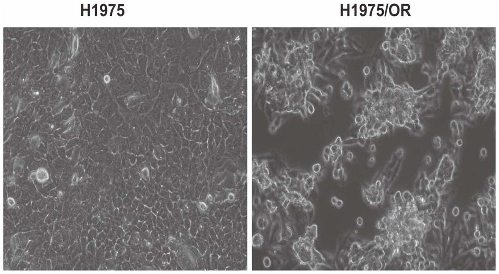 Osimertinib-resistant human non-small cell lung cancer cell strain H1975/OR and application thereof