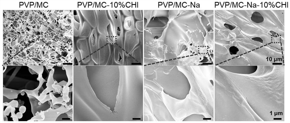 Preparation method of medical sustained-release gel with microporous structure and cold compress gel for treating dermatitis and eczema