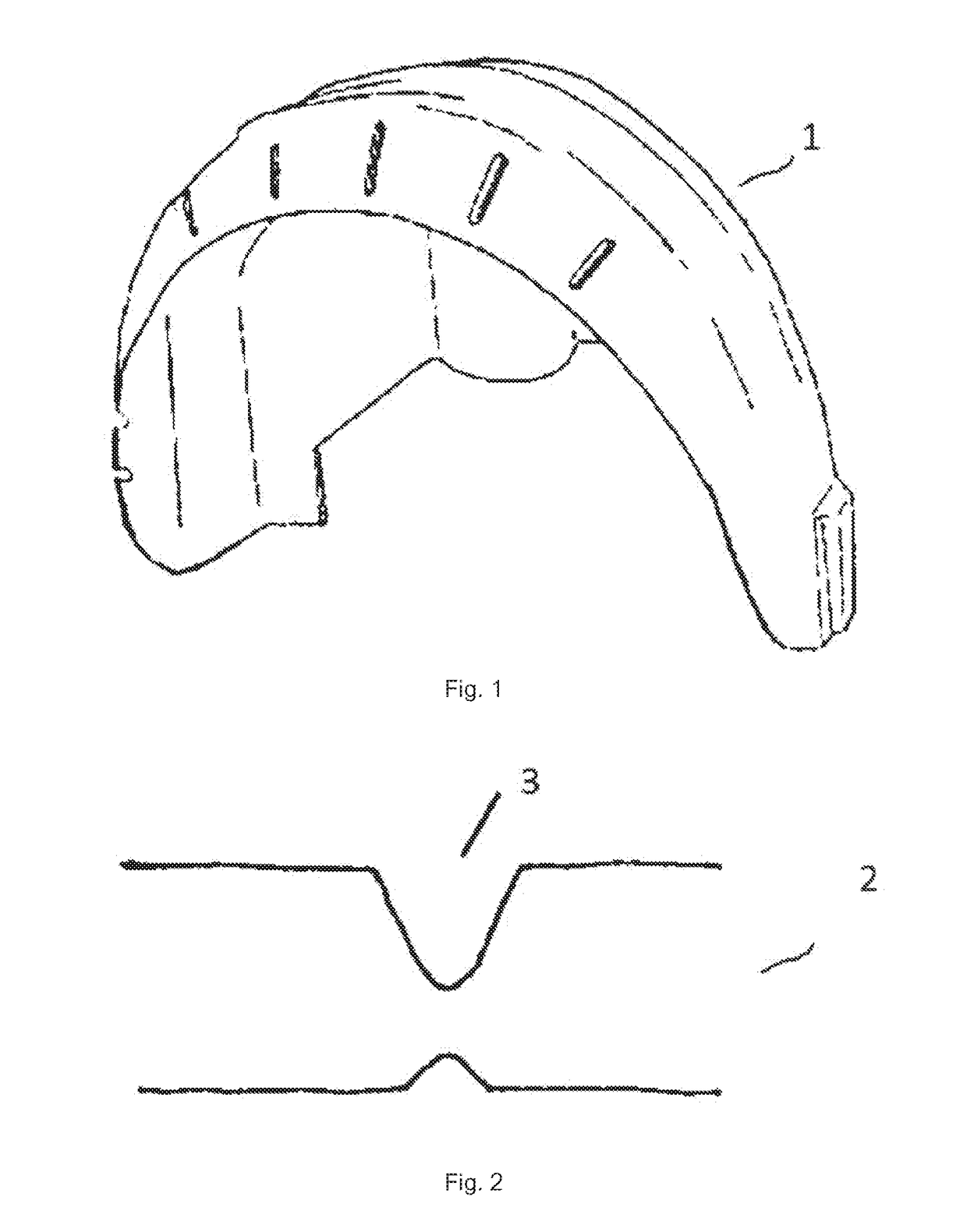 Wheel arch liner for a vehicle