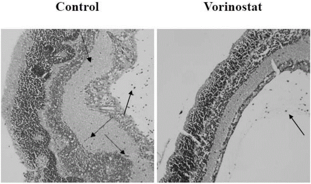 Application of vorinostat for preparation of immunomodulatory drugs