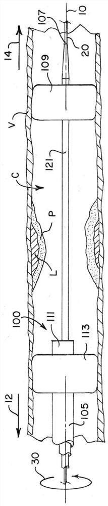 Intravascular plaque isolation, destabilization, and aspiration