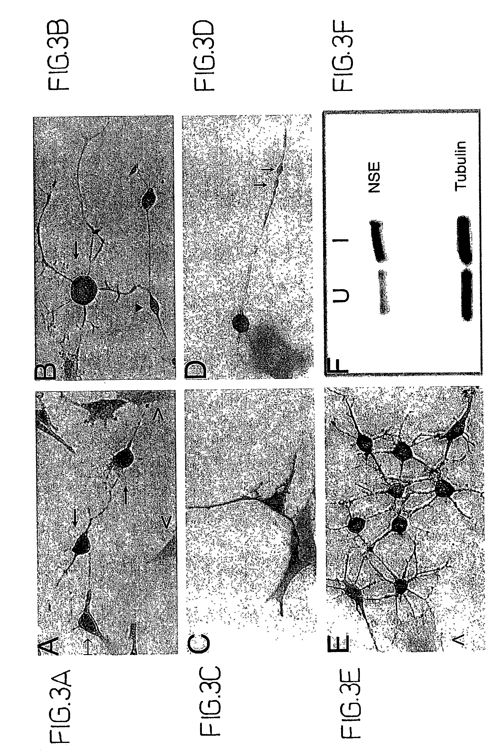 Differentiation of bone marrow cells into neuronal cells and uses therefor