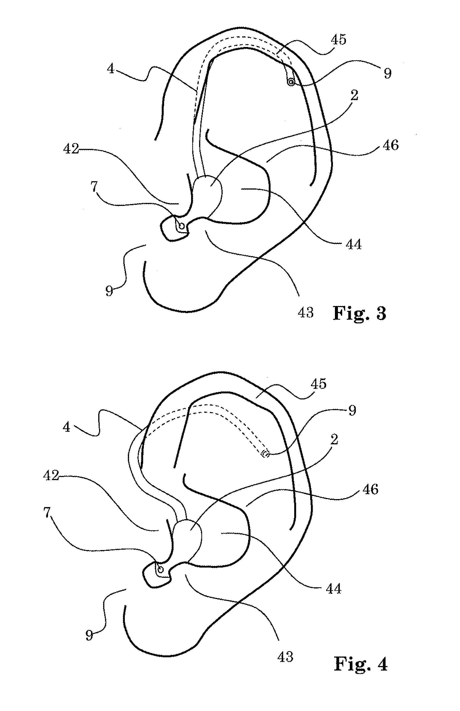 Hearing device with a vent extension and method for manufacturing such a hearing device
