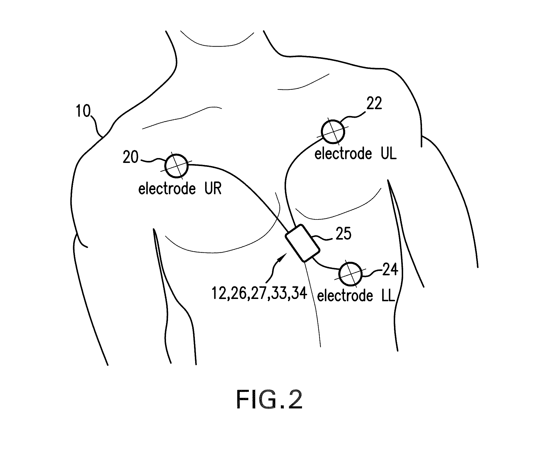 Body-worn monitor for measuring respiratory rate