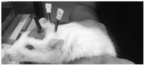 Deep brain stimulation electrode device