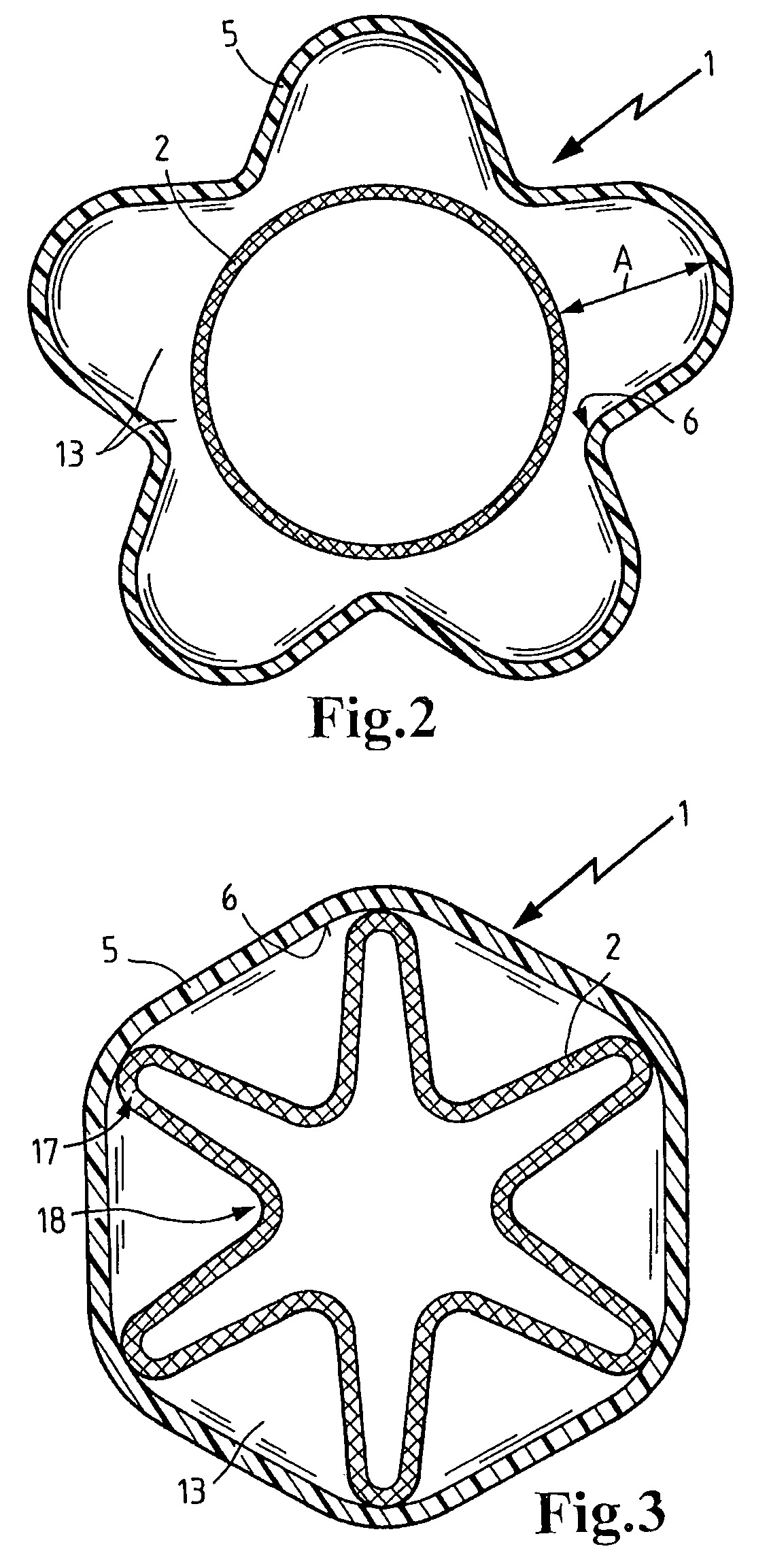 Filter pipeline