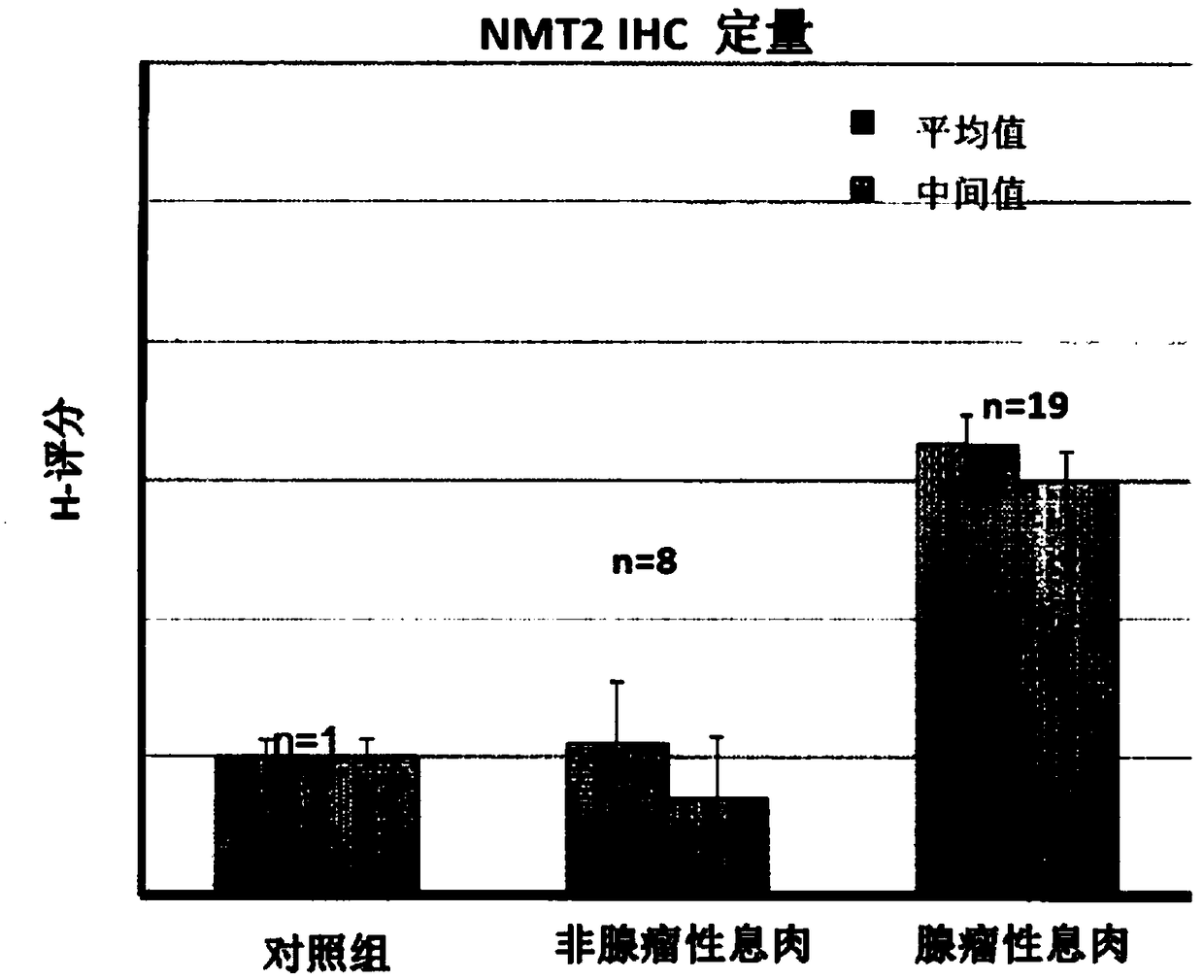 N-myristoyltransferase (NMT)1, nmt2 and methionine aminopeptidase 2 overexpression in peripheral blood and peripheral blood mononuclear cells is a marker for adenomatous polyps and early detection of colorectal cancer