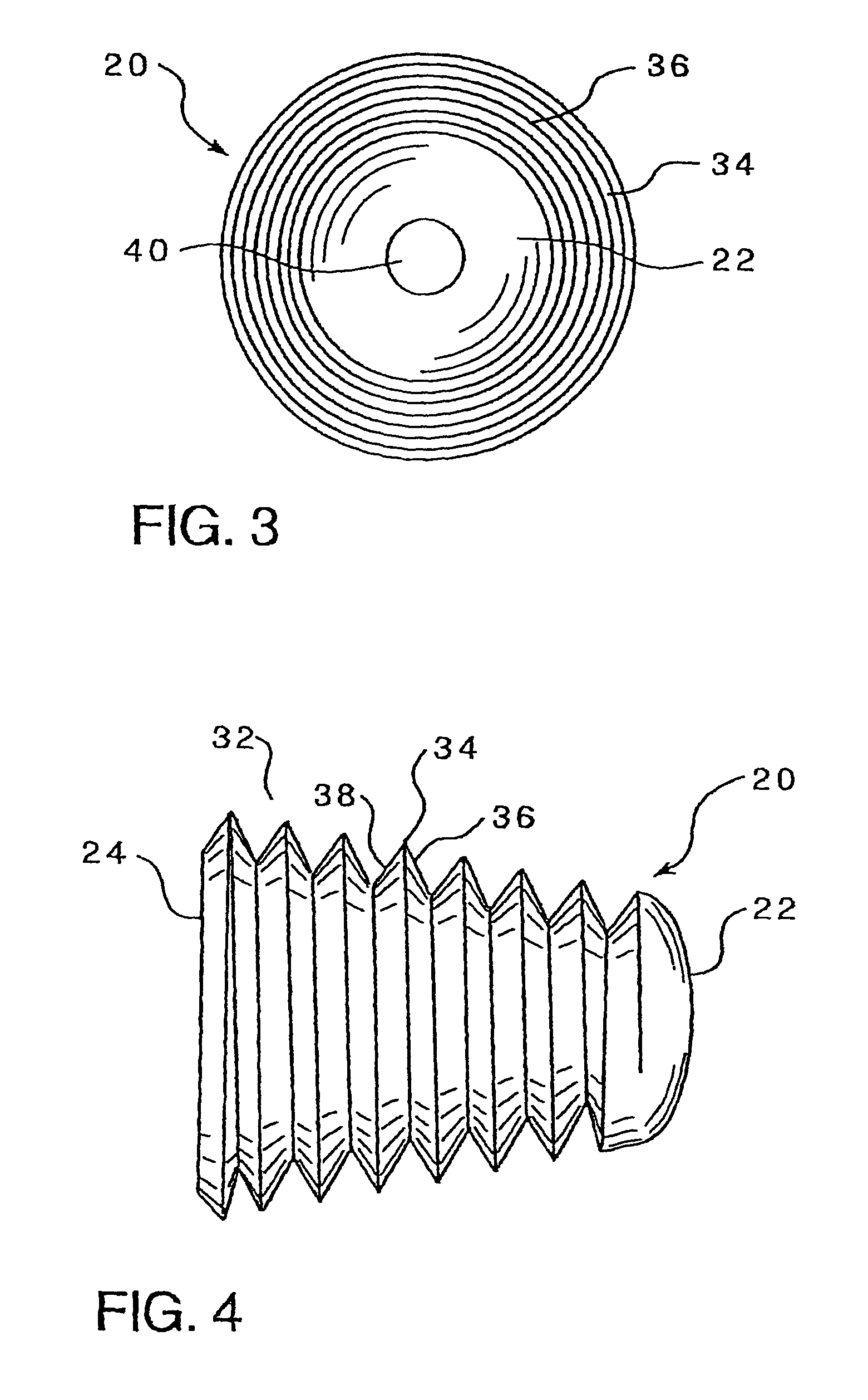 Subtalar implant and methods of use thereof