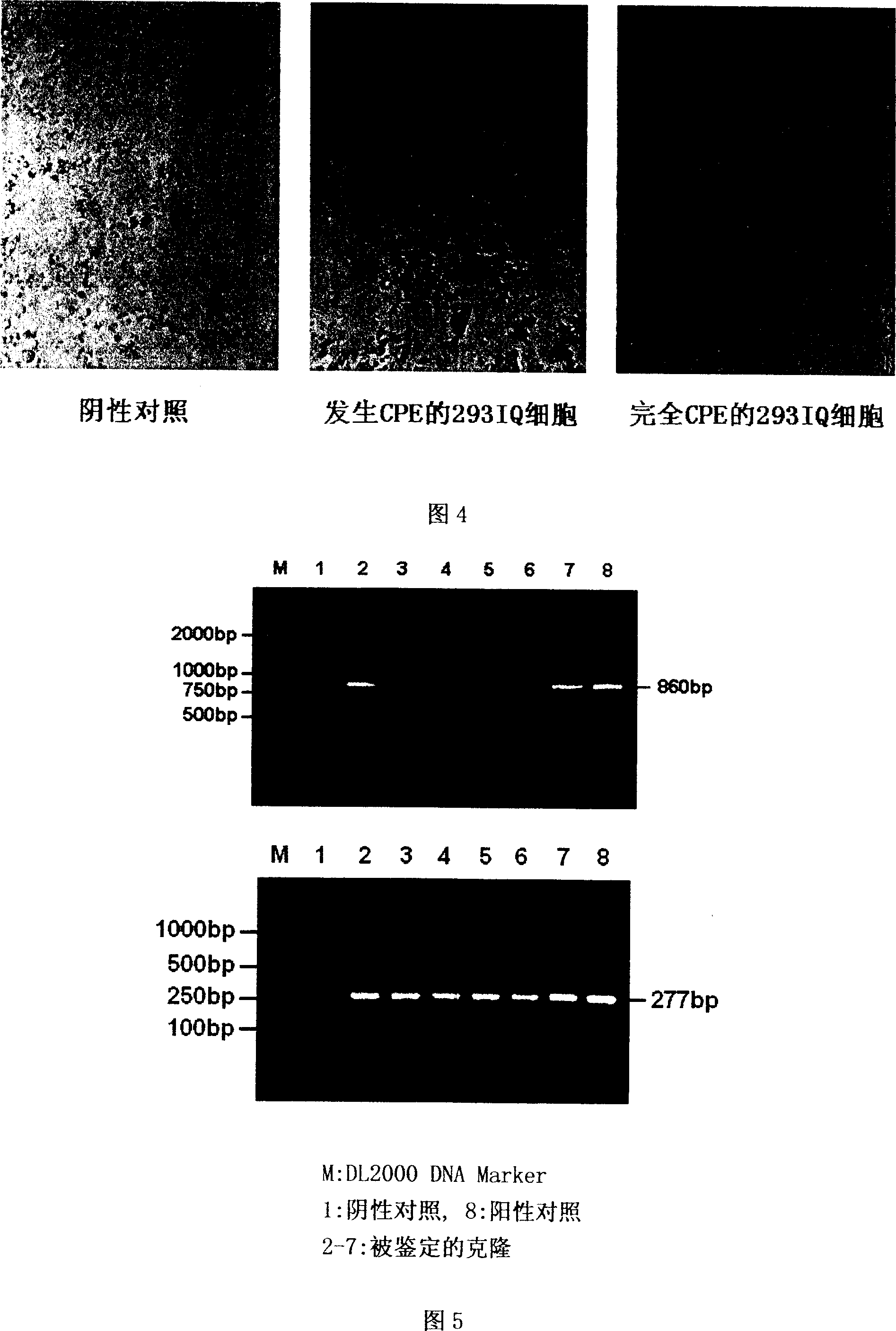 Recombinant of intelligent adenovirus vector and khp53 gene and application thereof