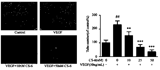 Application of gamabufotalin to angiogenesis inhibiting medicine preparation and pharmaceutical preparation of gamabufotalin