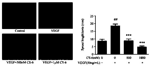 Application of gamabufotalin to angiogenesis inhibiting medicine preparation and pharmaceutical preparation of gamabufotalin