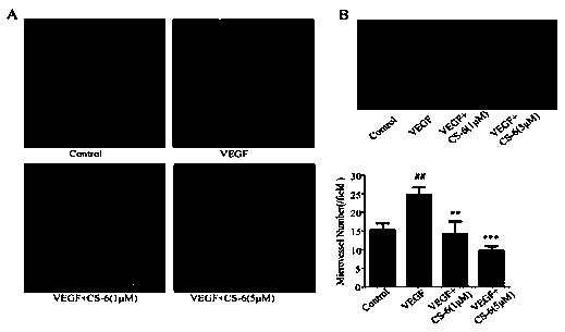 Application of gamabufotalin to angiogenesis inhibiting medicine preparation and pharmaceutical preparation of gamabufotalin