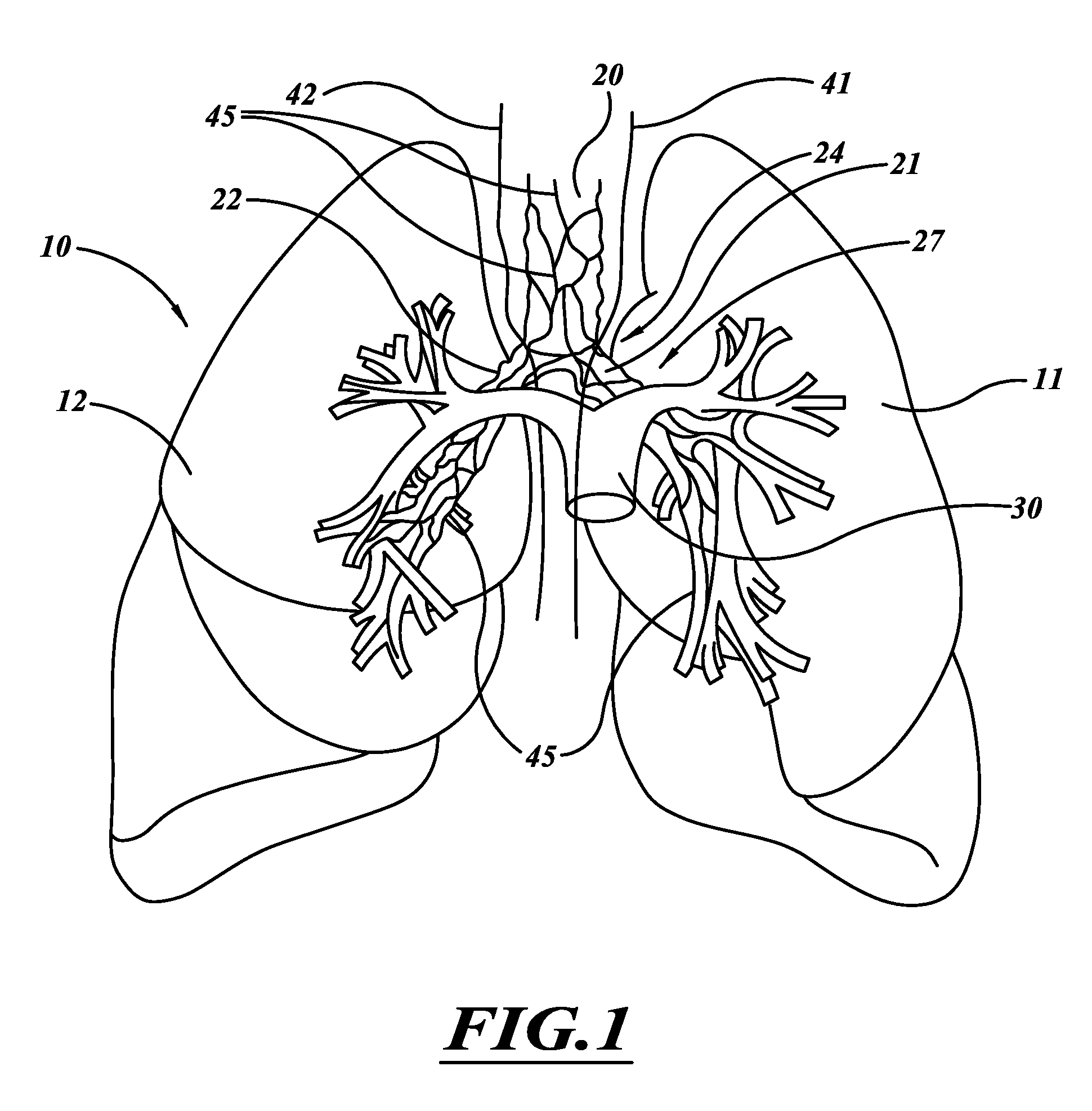Systems, apparatuses, and methods for treating tissue and controlling stenosis