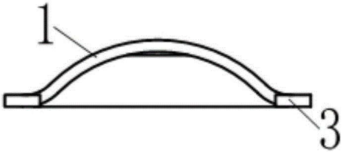 Anterior cruciate ligament tibia condyles spina intercondyloidea avulsion fracture fixation steel plate