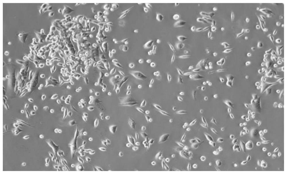 Isolated culture and subculture method of mouse breast cancer cells