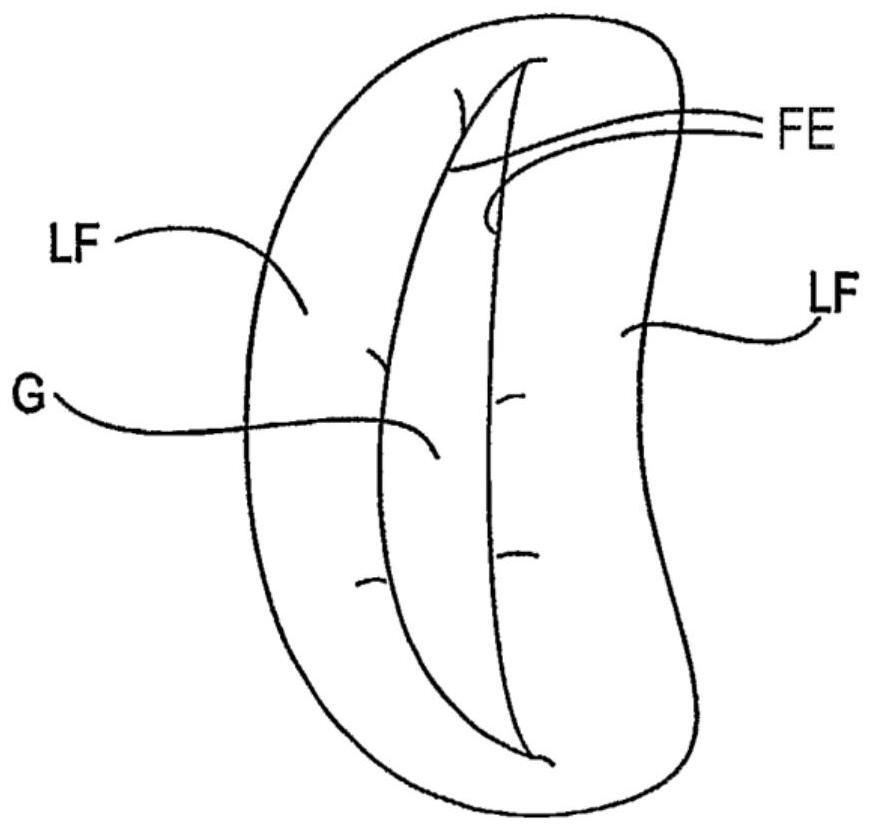 Improved tissue fixation device