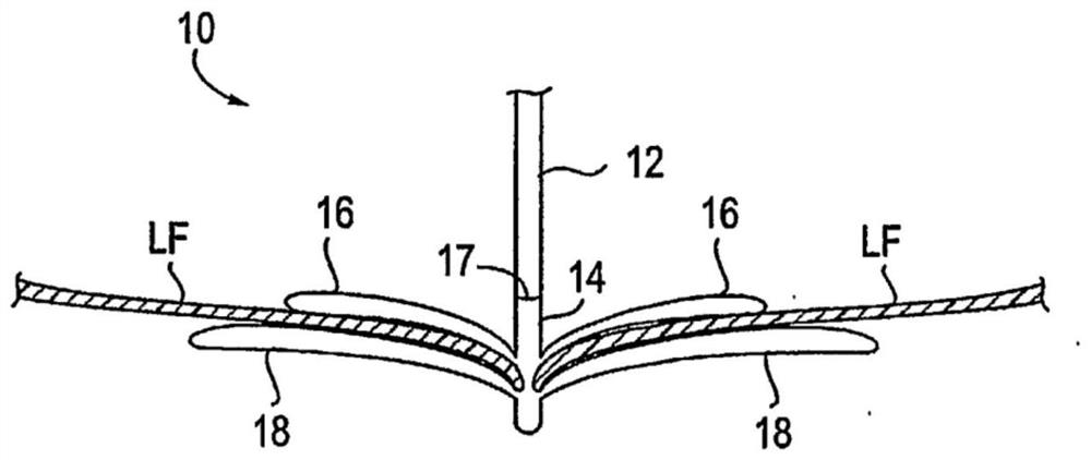 Improved tissue fixation device