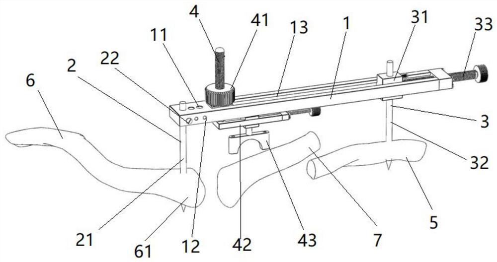 Clavicle fracture closed reduction device and method