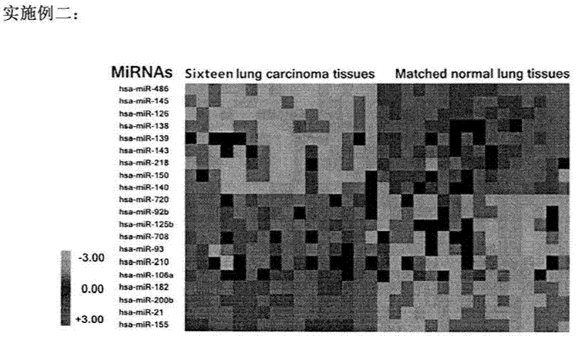 Detection of microRNAs in excreta as early diagnosis biomarker of lung cancer, colorectal cancer and bladder cancer