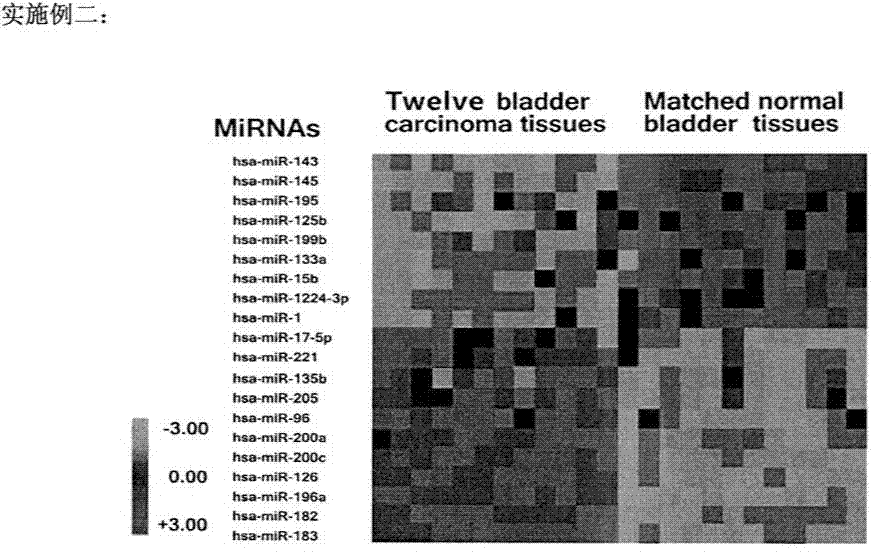 Detection of microRNAs in excreta as early diagnosis biomarker of lung cancer, colorectal cancer and bladder cancer
