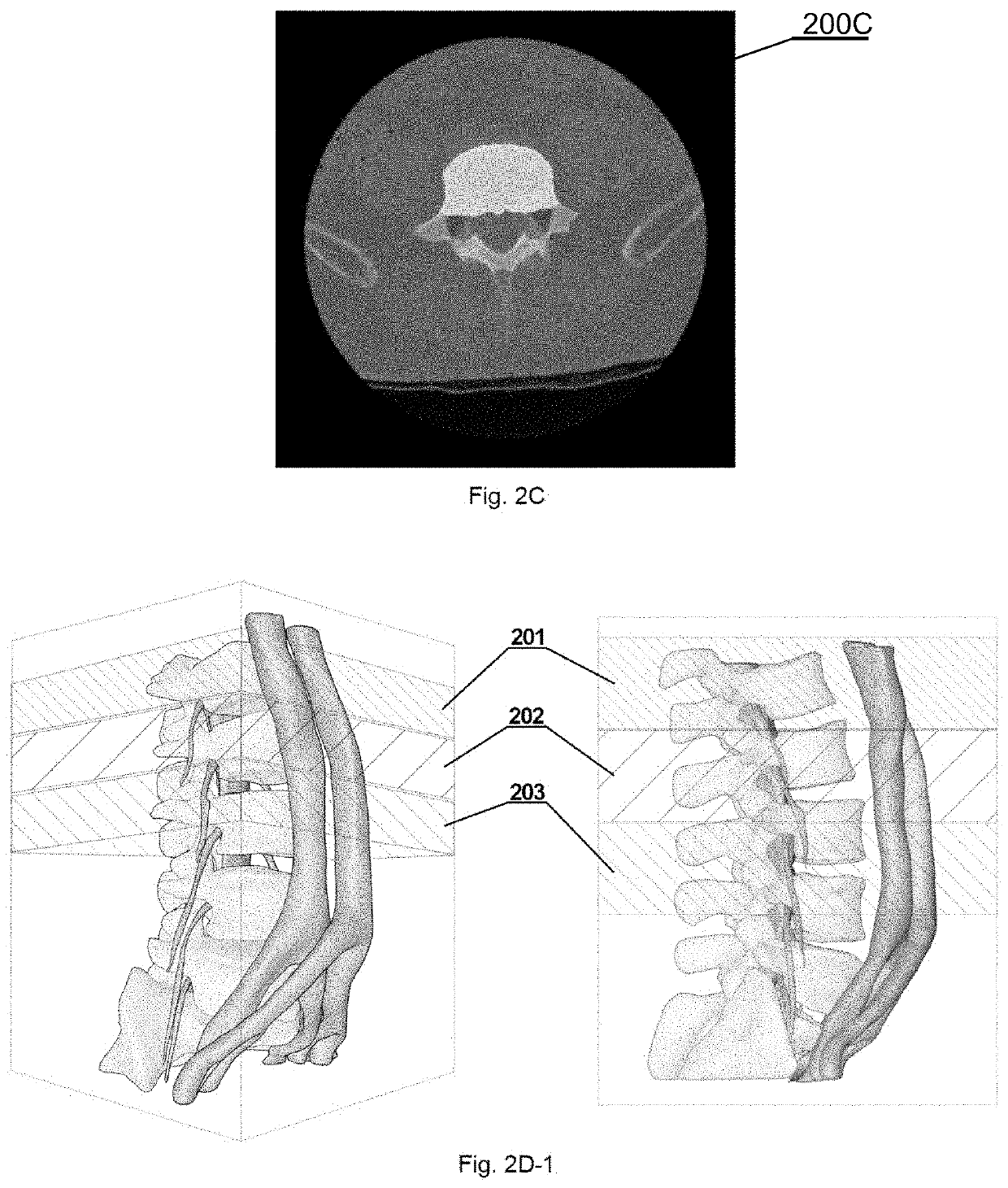 Autonomous multidimensional segmentation of anatomical structures on three-dimensional medical imaging