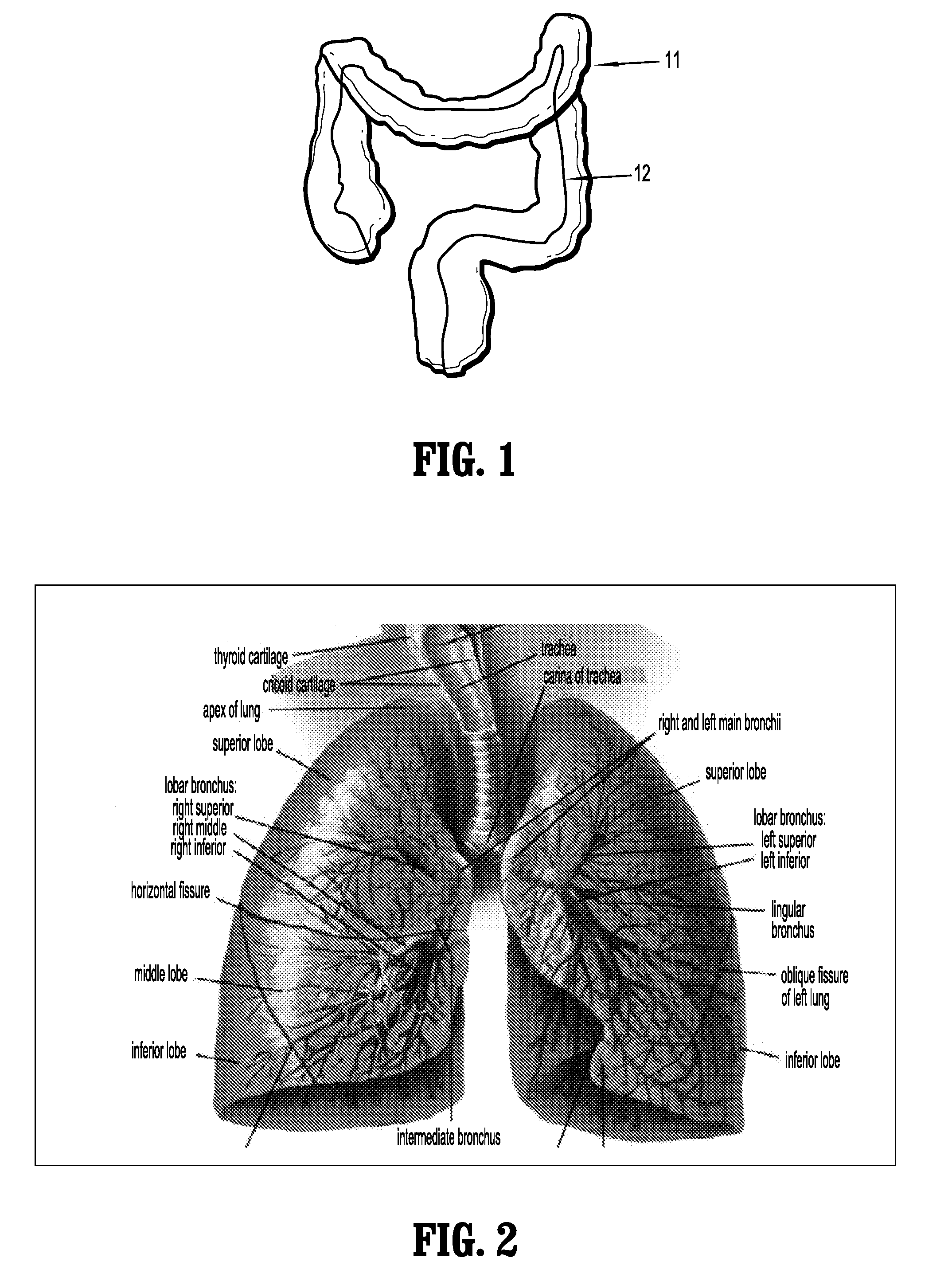 System and Method for Lesion Detection Using Locally Adjustable Priors