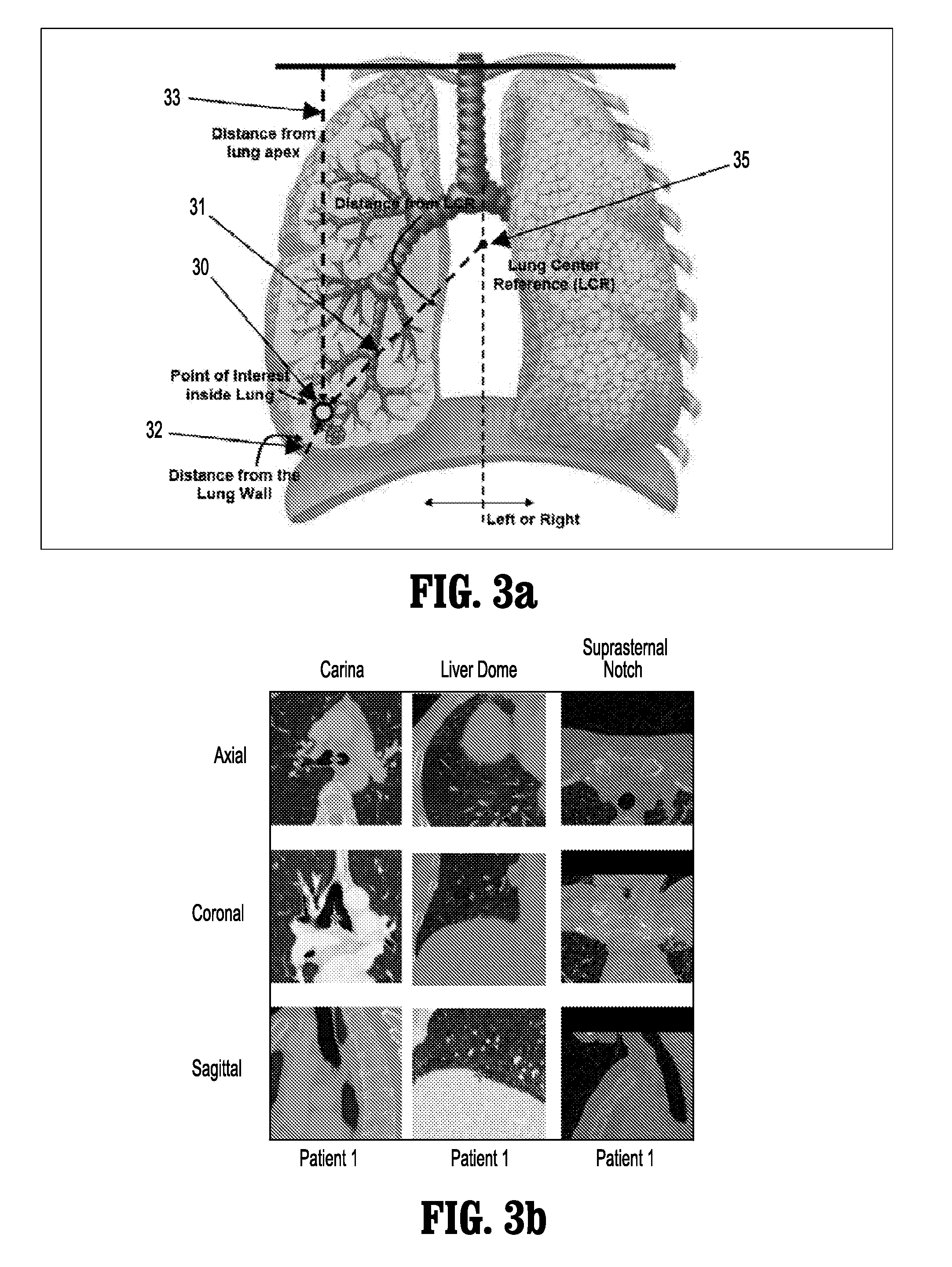 System and Method for Lesion Detection Using Locally Adjustable Priors