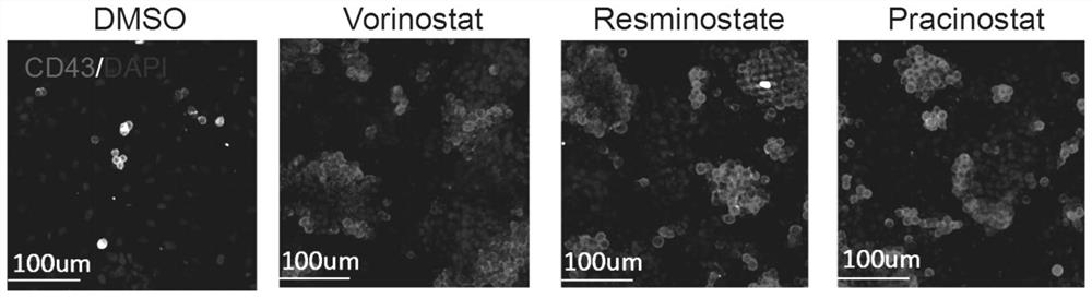 Use of histone deacetylase inhibitors in the preparation of products that promote the differentiation of pluripotent stem cells into hematopoietic stem and progenitor cells