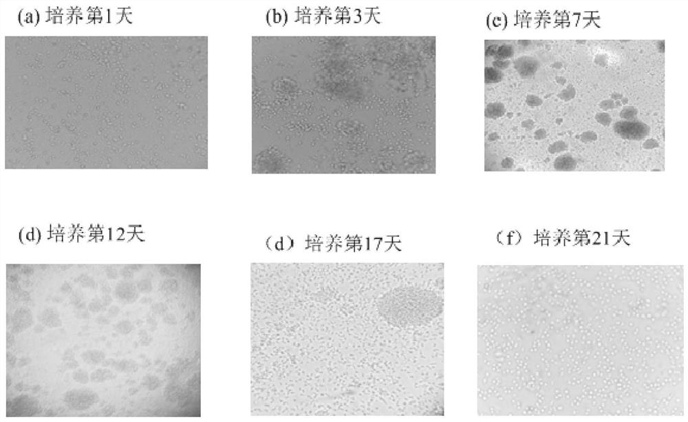 Processing method of human peripheral blood T lymphocytes and immunogen preparation and application