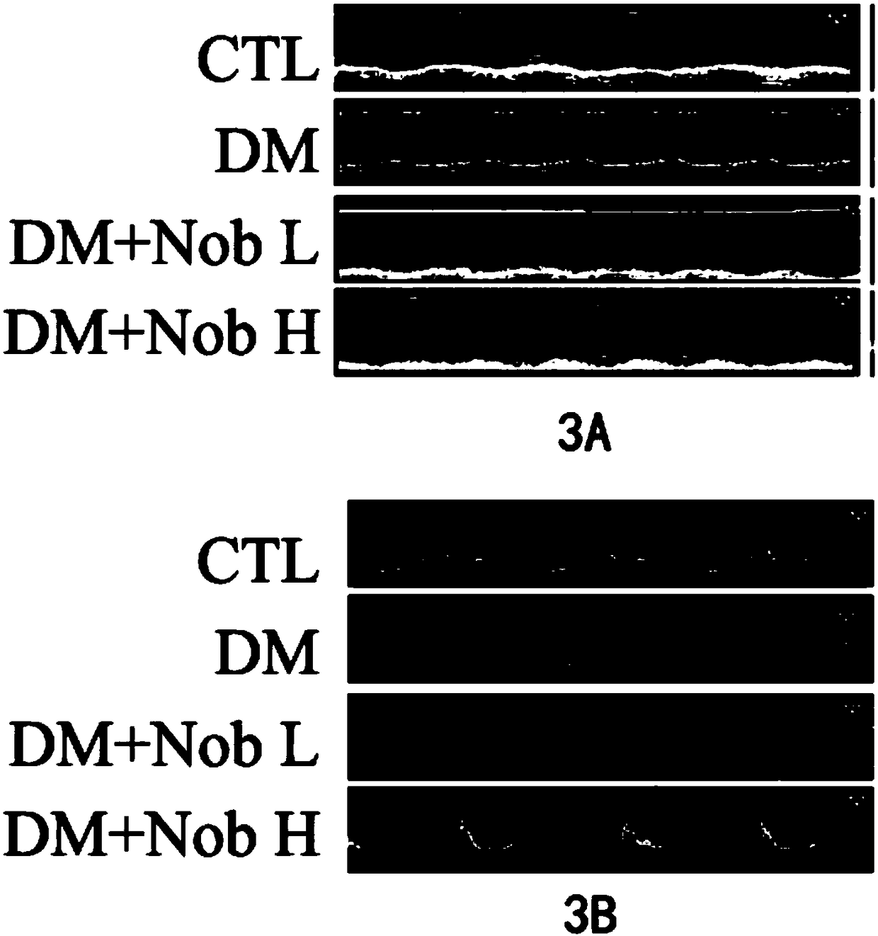 Application of nobiletin in preparation or screening of drugs for treating diabetes and cardiomyopathy