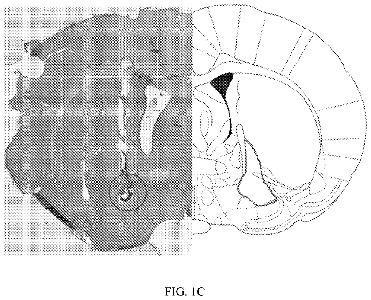 Stimulation of the ventral pallidum for the treatment of epilepsy