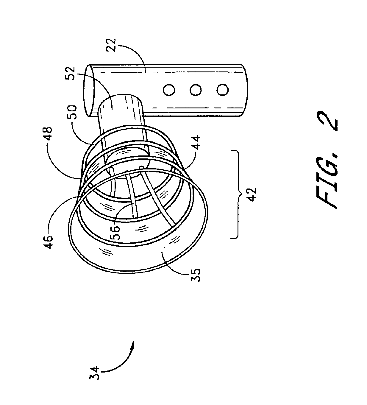 Method and apparatus for noninvasive intraductal fluid diagnostic screen