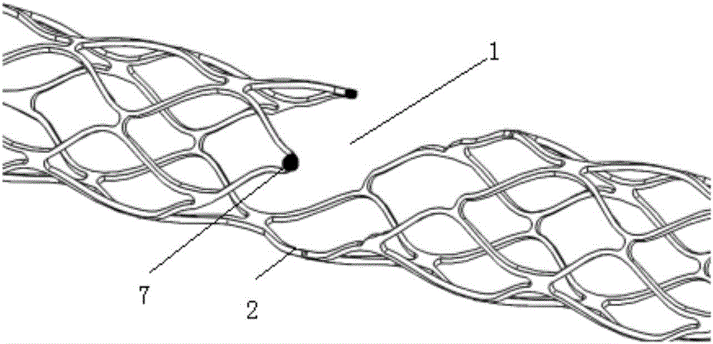 Sectional thrombus extraction device and thrombus extraction method making use of thrombus extraction device