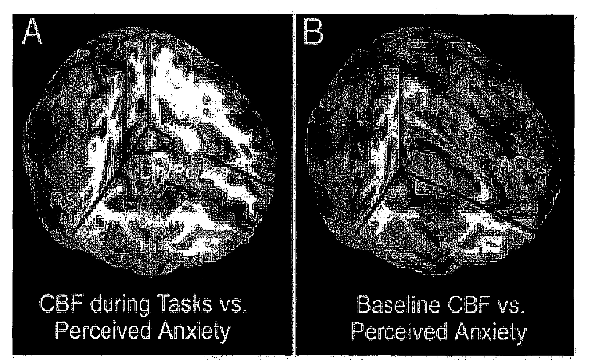 Assessing subject's reactivity to psychological stress using fmri