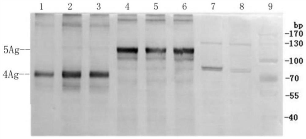 A recombinant tuberculosis vaccine, its preparation method and application