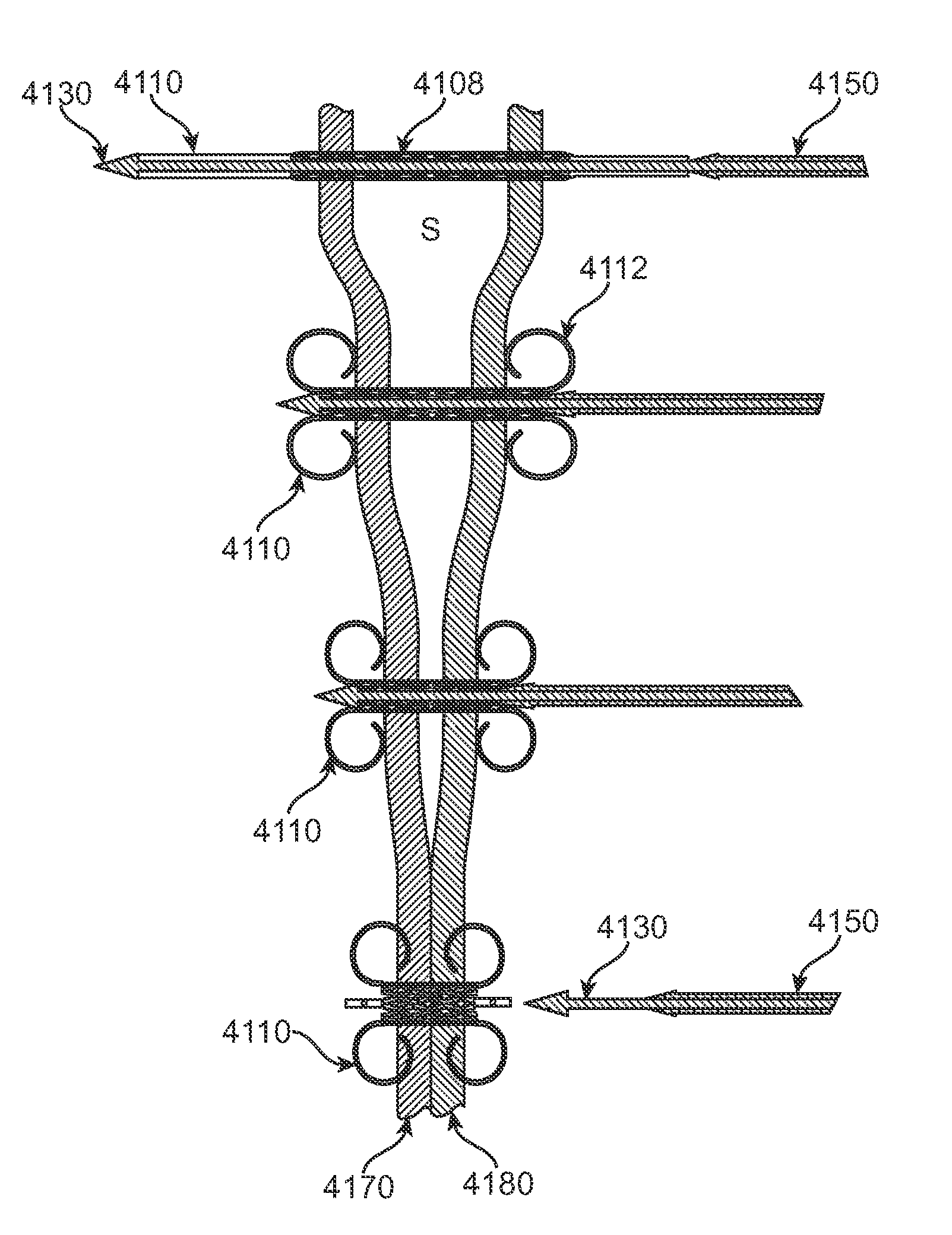 Luminal structure anchoring devices and methods