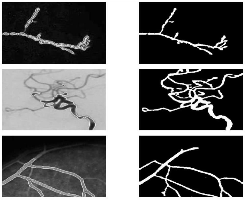 Image segmentation method based on visual salient region and active contour