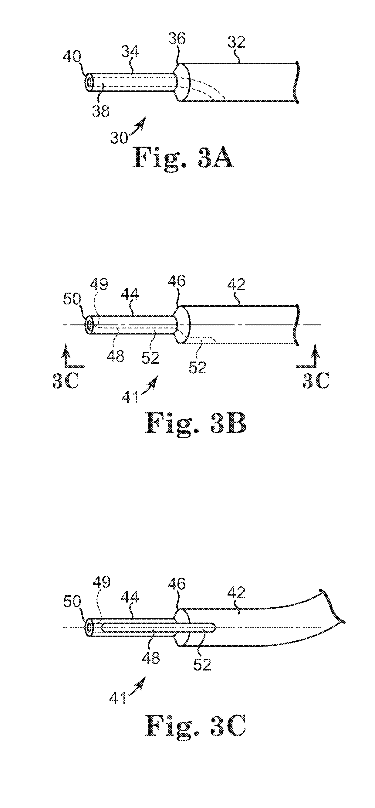 Surgical Articles and Methods for Treating Pelvic Conditions