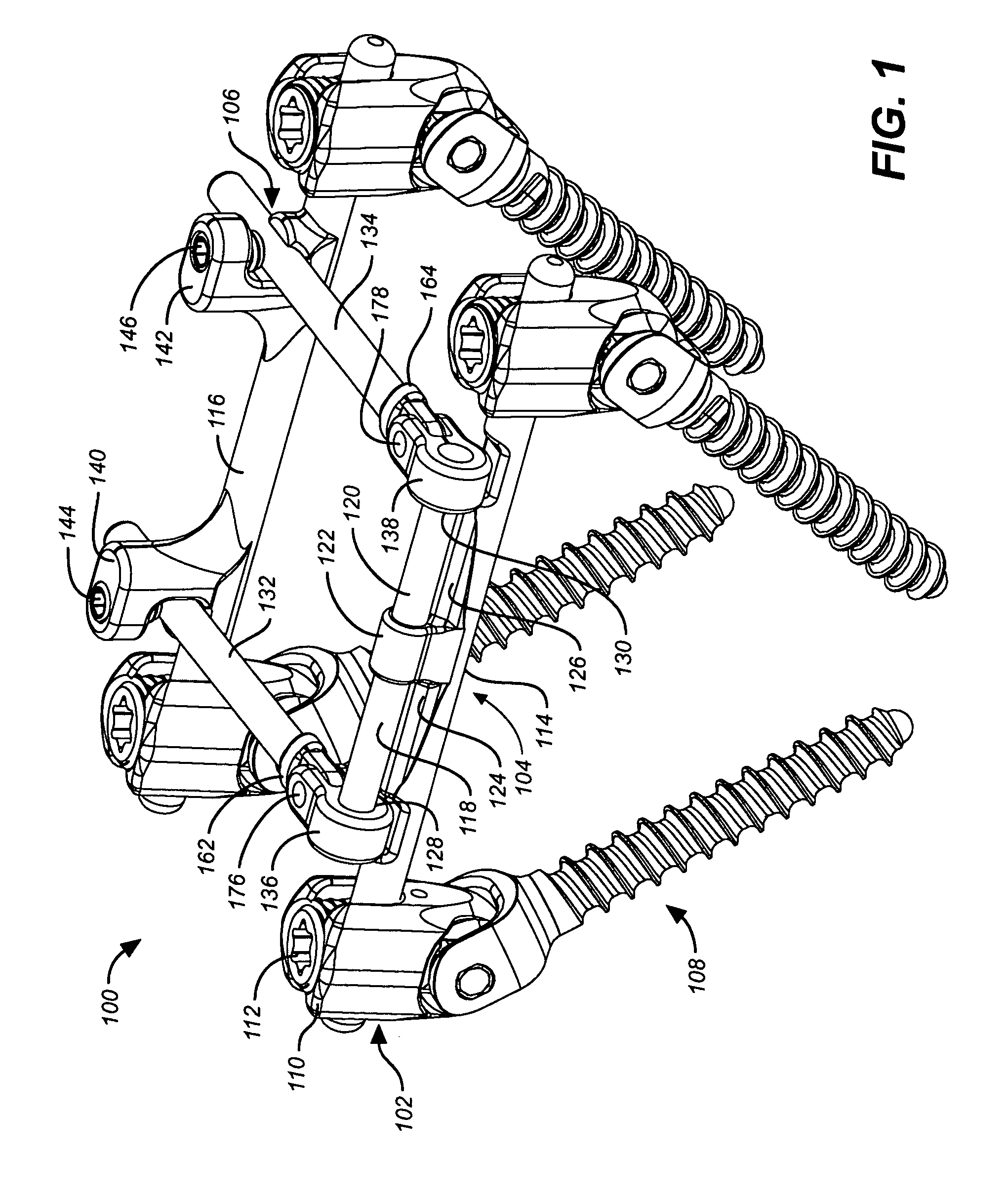 Deflection rod system for spine implant with end connectors and method