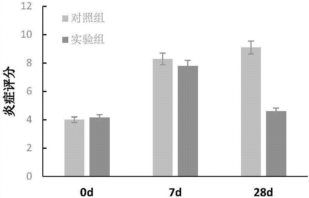 Application of galactooligosaccharide in preparation of medicine for treating intestinal diseases