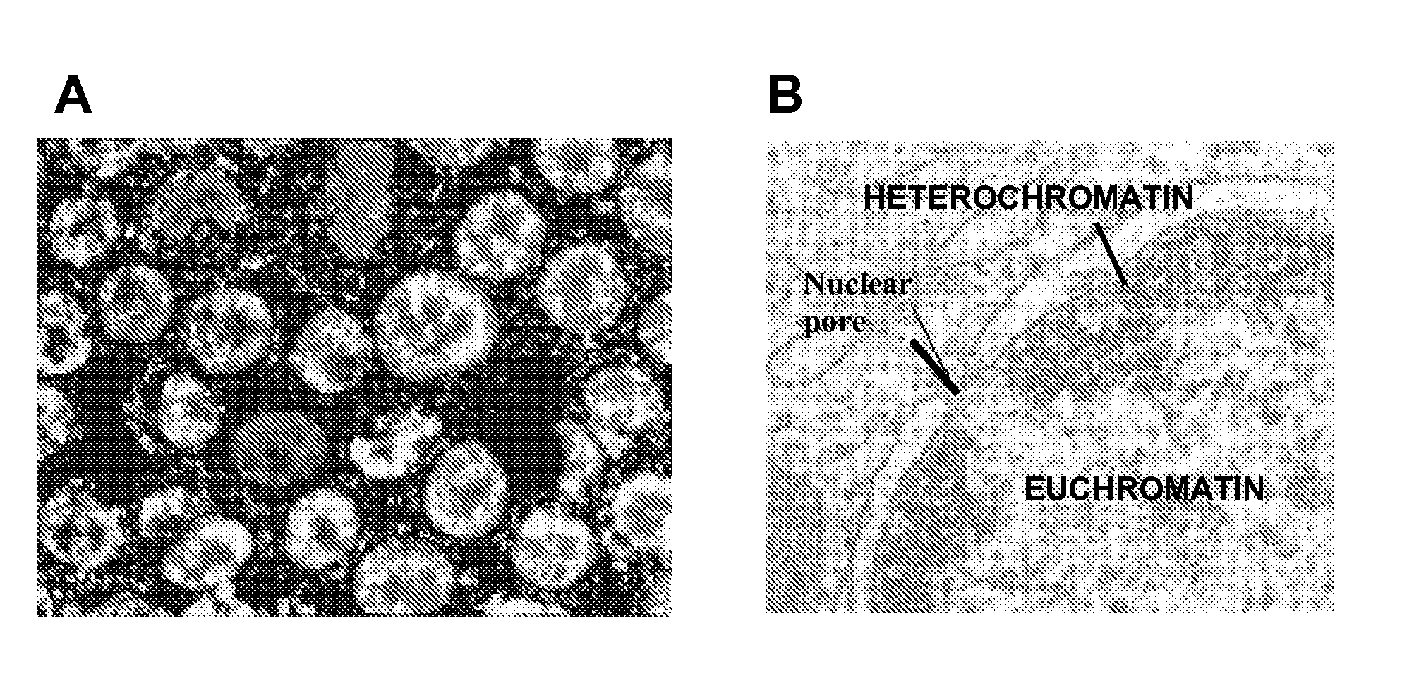 Method for the analysis of differential expression in colorectal cancer